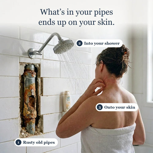 Vanto Skin Barrier Shower Filter